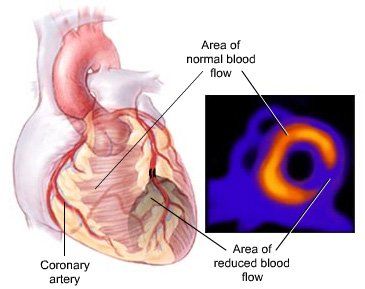 Book Nuclear Stress Test - Dr. Rudd Cardiology